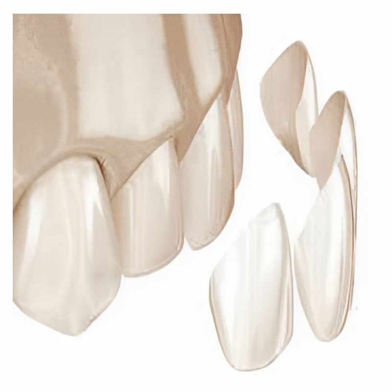 Image for  Service: Crowns & Veneers